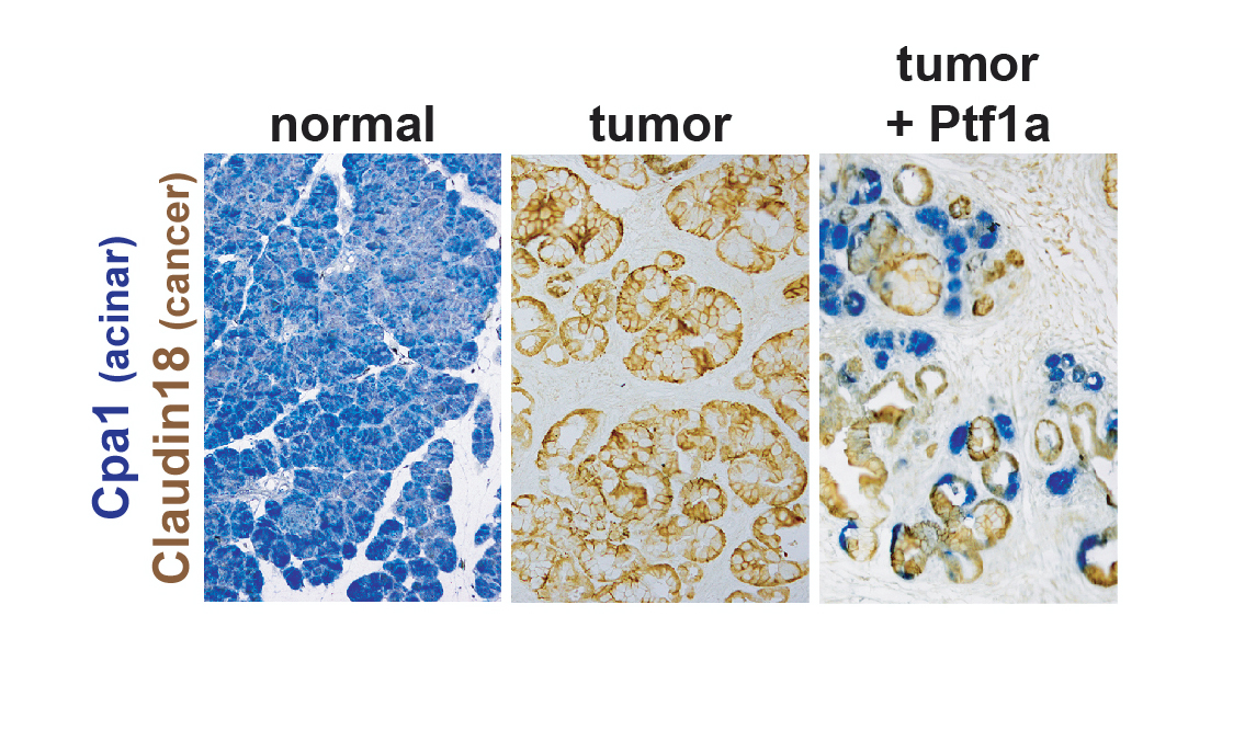 Cellular Origins Of Pancreatic Cancer Discovery And Innovation At 