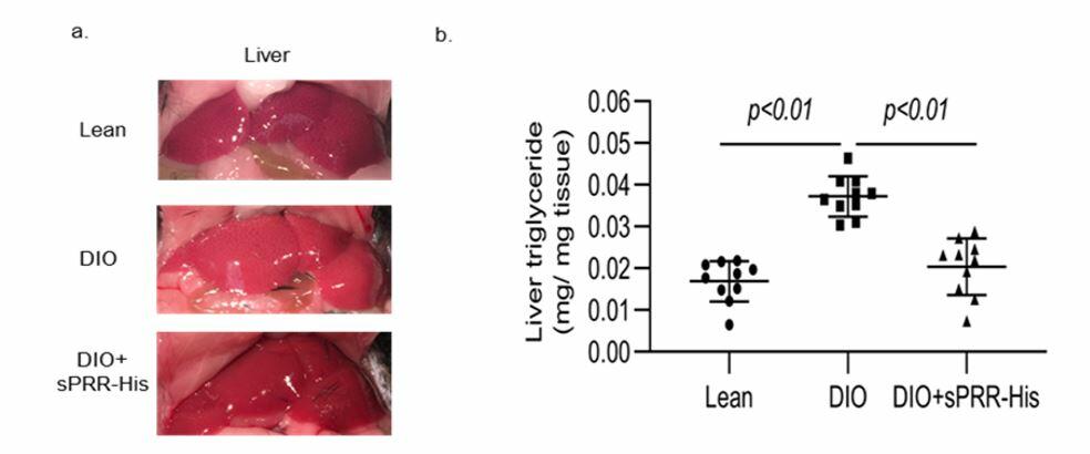 Recombinant sPRR ameliorates fatty liver as well as other components of metabolic syndrome in mice with diet-induced obesity. Normal diet (lean); diet-induced obesity (DIO); histidine-tagged sPRR (sPRR-His).