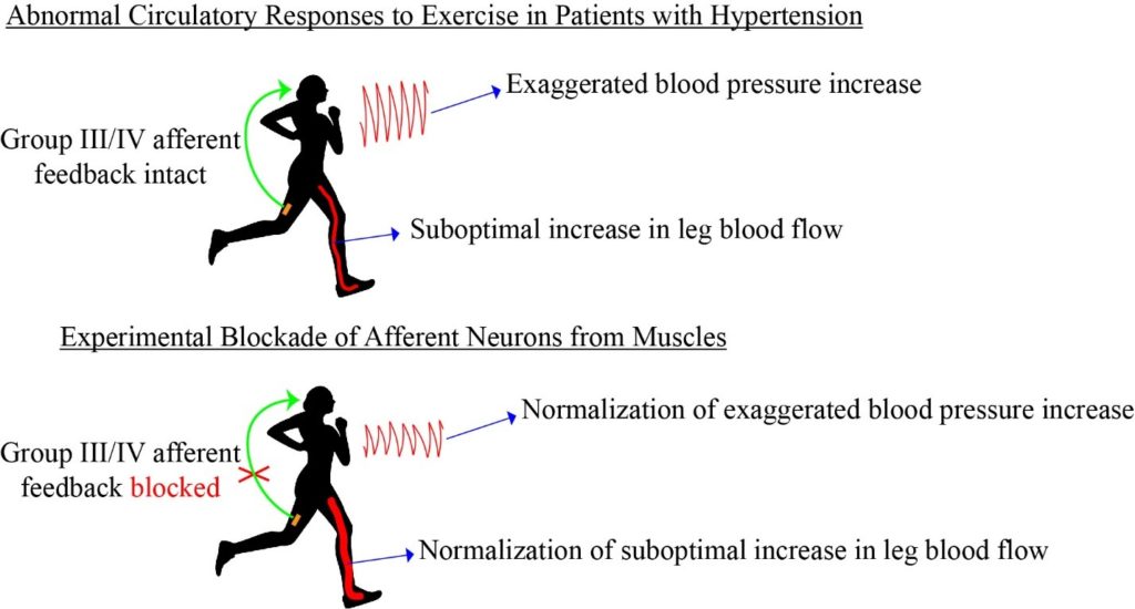 Graphic- Mechanisms of Circulatory Abnormalities and Fatigue in Patients with Cardiovascular Diseases